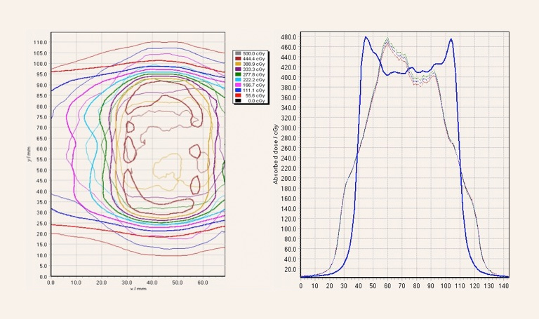 4D Radiotherapy Charts